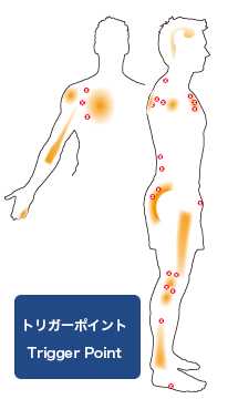 トリガーポイントとは